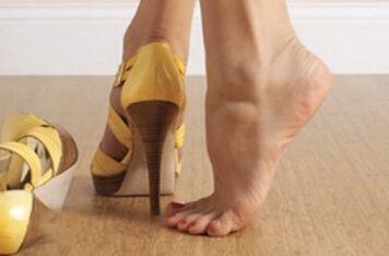 Rejet de talons hauts